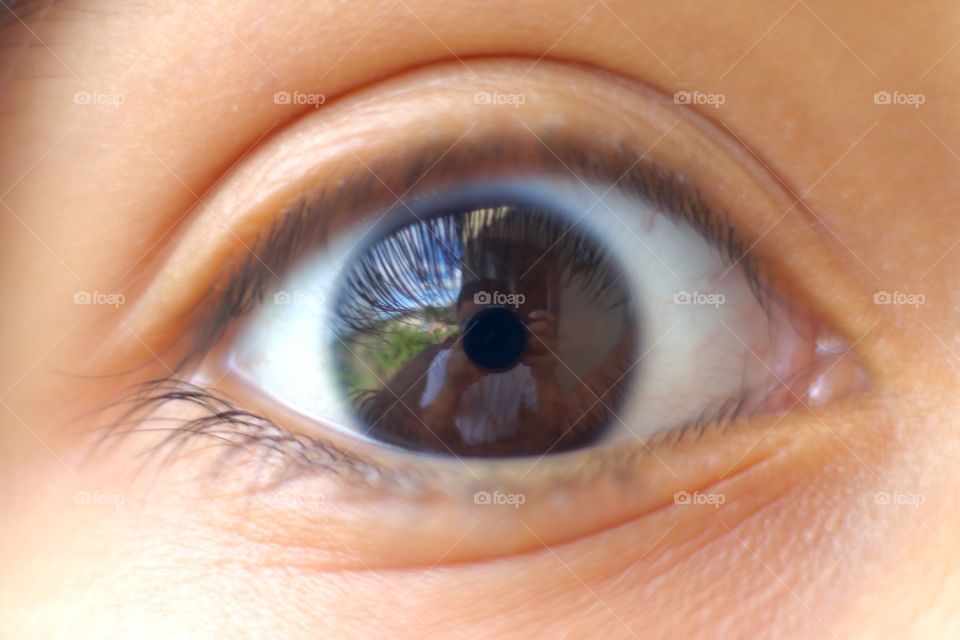 Eye ball