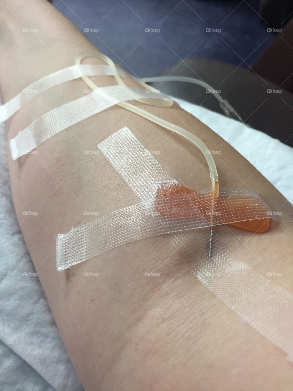 Day in the life with Lupus