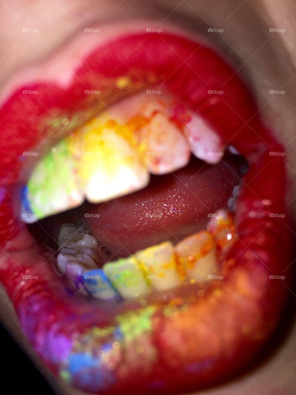 Rainbow teeth