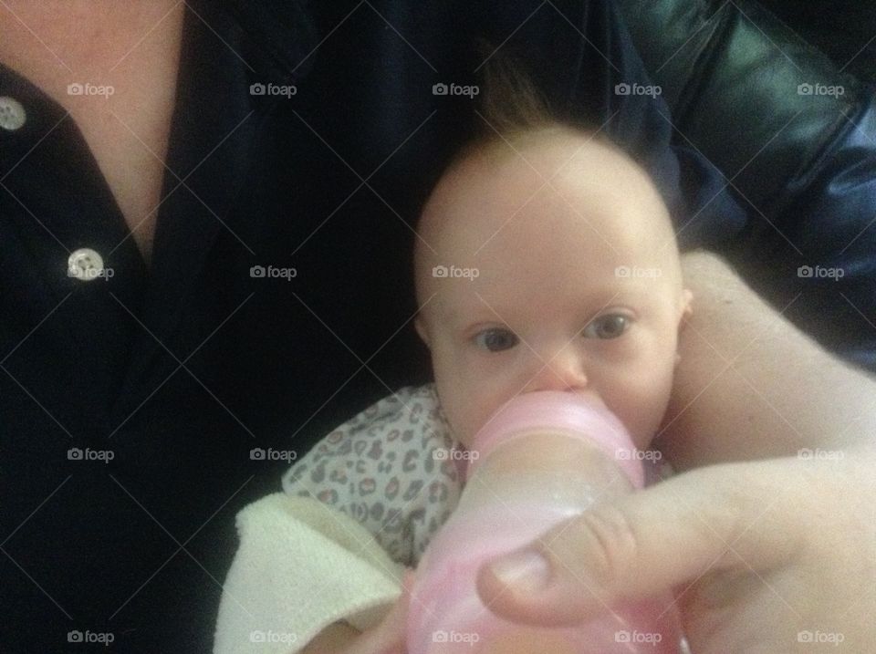 Baby with Down syndrome drinking from bottle