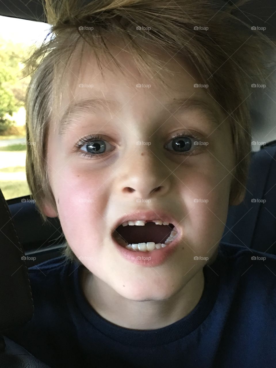 Lost a tooth!