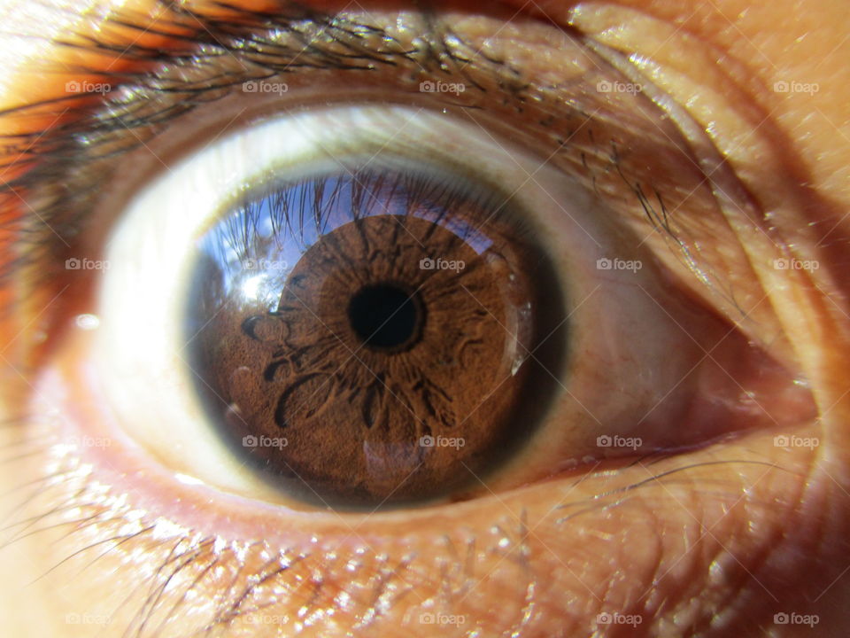 iris eye