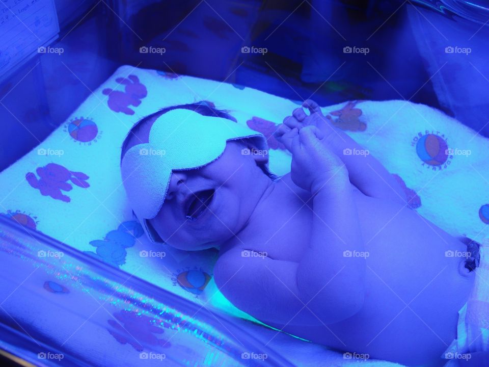 Newborn Under UV Lights