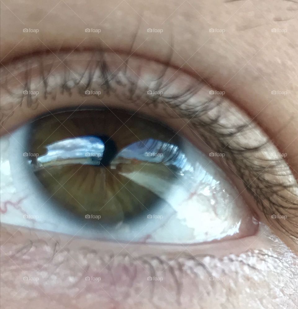 Reflection in the eye
