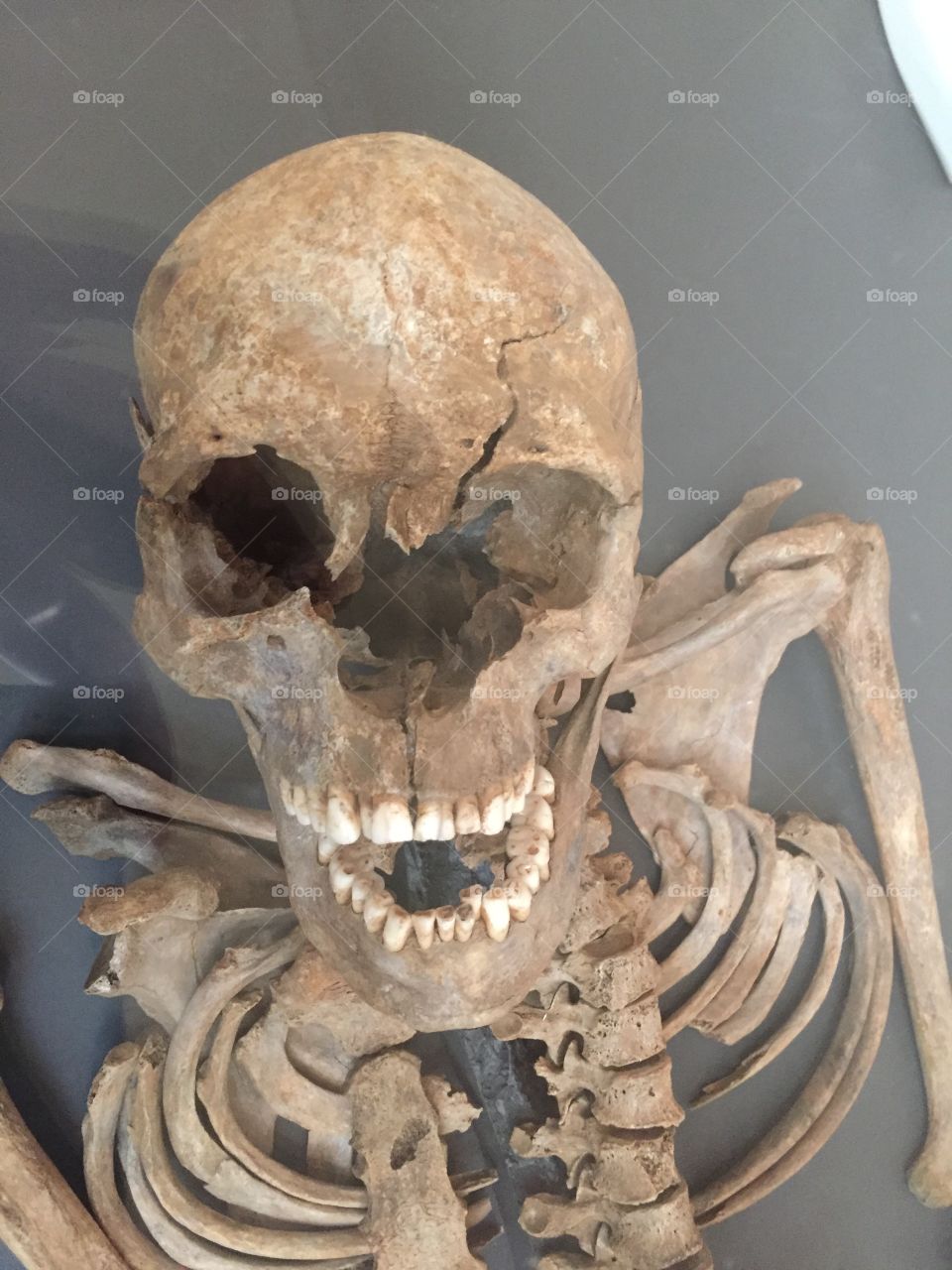 Skeleton remains 