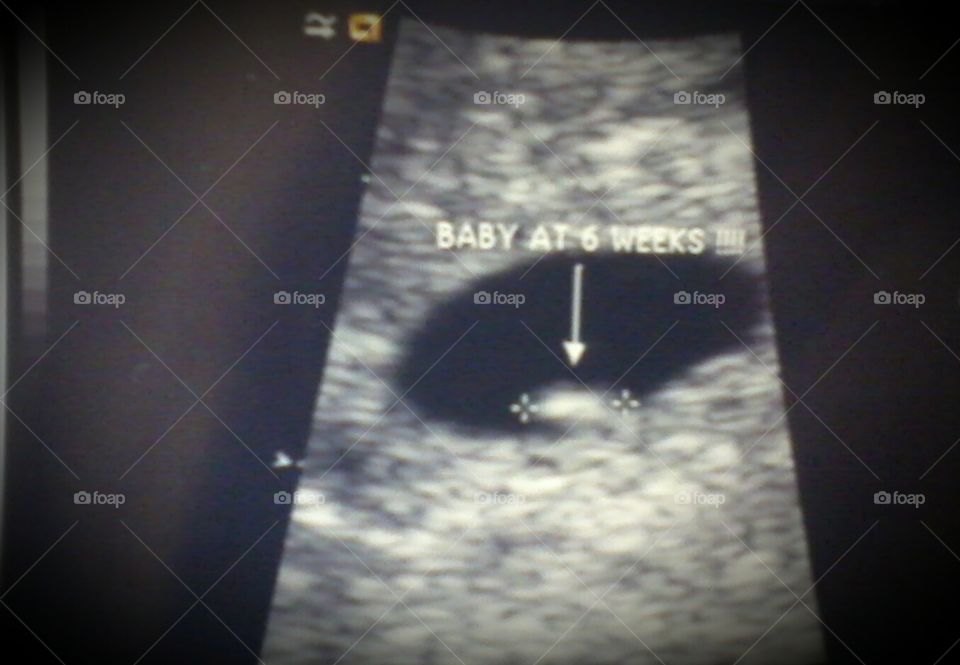 Fetus at 6 Weeks