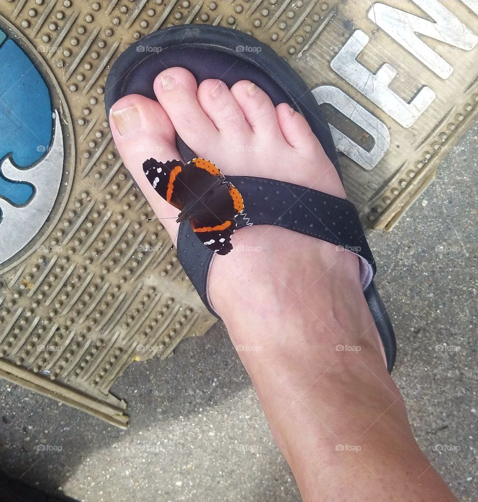 butterfly like ugly foot