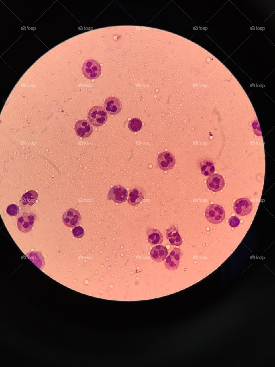 Neutrophils monocytes Eosinophils in PDF 
