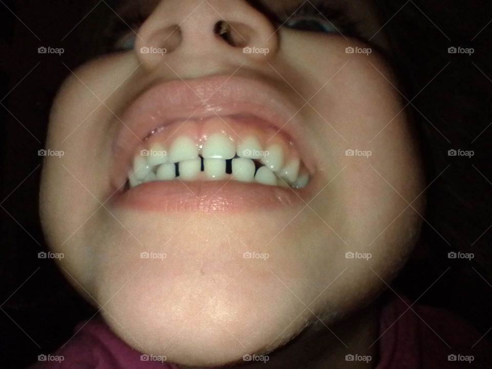 boca de una niña donde se ven los dientes , los labios la pera , la nariz y las fosas nasales