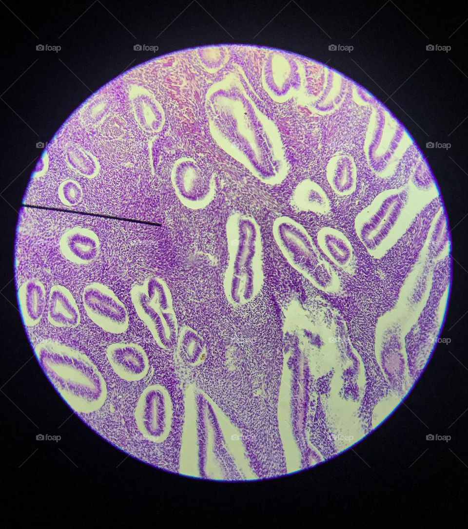 Endometrial cells under the microscope