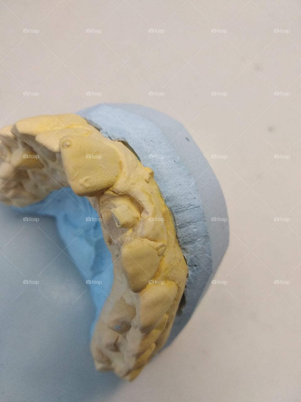 Dental model